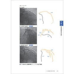 ヨドバシ.com - 確実に身につく心臓カテーテル検査の基本とコツ―冠動脈 