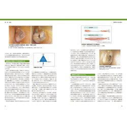ヨドバシ.com - 鼓膜再生療法手術手技マニュアル [単行本] 通販