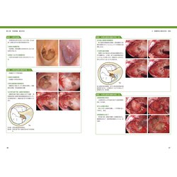 ヨドバシ.com - 鼓膜再生療法手術手技マニュアル [単行本] 通販