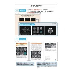 ヨドバシ.com - 症例で学ぶ中枢神経の画像診断［Web動画付］ [単行本 