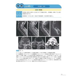 ヨドバシ.com - 症例で学ぶ中枢神経の画像診断［Web動画付］ [単行本 