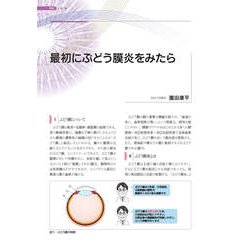ヨドバシ.com - ぶどう膜炎の心得 (新篇眼科プラクティス 8)(新