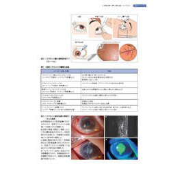 ヨドバシ.com - ぶどう膜炎の心得 (新篇眼科プラクティス 8)(新