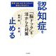 認知症を止める「脳ドック」を活かした対策―異変(萎縮・血管)をつかんで事前に手を打つ [単行本]