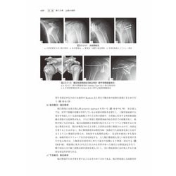 ヨドバシ.com - 骨折・脱臼―FRACTURES & DISLOCATIONS 改訂5版 [単行本 