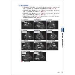 ヨドバシ.com - 3DCTで解剖から学ぶ腹部エコーの基本とコツ―血管を指標にした走査法と超音波所見をマスターする [単行本] 通販【全品無料配達】