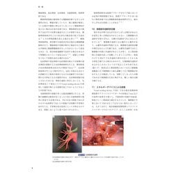 呼吸器外科 Morbidity and mortality conference ヨドバシ.com - 呼吸器外科 morbidity and mortality conference