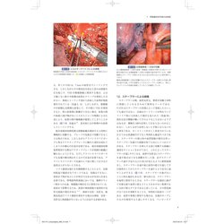 ヨドバシ.com - 呼吸器外科 morbidity and mortality conference