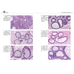 ヨドバシ.com - 乳腺病理パーフェクトアトラス [単行本] 通販【全品