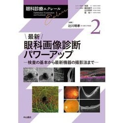 最新 眼科画像診断パワーアップ(眼科診療エクレール〈2〉) [全集叢書]