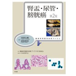 腎盂・尿管・膀胱癌 第2版 (腫瘍病理鑑別診断アトラス) [単行本]