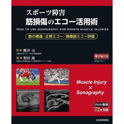 スポーツ障害筋損傷のエコー活用術―筋の構造/正常エコー/損傷部エコー評価 [単行本]