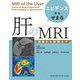 エビデンスからせまる肝のMRI―撮像から診断まで [単行本]