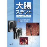 大腸ステントハンドブック [単行本]