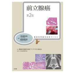 ヨドバシ.com - 前立腺癌 第2版 (腫瘍病理鑑別診断アトラス