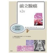 前立腺癌 第2版 (腫瘍病理鑑別診断アトラス) [単行本]