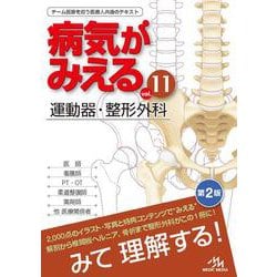 病気がみえる<vol.11>－運動器・整形外科 第2版 [単行本]