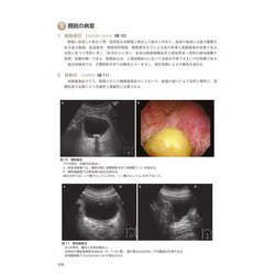 腹部超音波教科書 第3版　医学書 腹部超音波テキスト〜上・下腹部〜 改訂第三版 (Atlas Series超