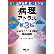 正常画像と比べてわかる　病理アトラス　第3版 第3版 [単行本]