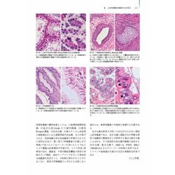 ヨドバシ.com - 卵巣腫瘍・卵管癌・腹膜癌 改訂・改題第2版