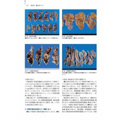 卵巣腫瘍・卵管癌・腹膜癌 改訂・改題第2版(腫瘍病理鑑別診断