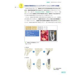 ヨドバシ.com - エビデンスに基づいたインプラント治療・骨造成