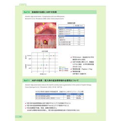ヨドバシ.com - エビデンスに基づいたインプラント治療・骨造成