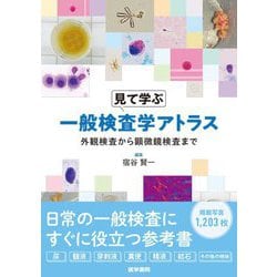 見て学ぶ一般検査学アトラス―外観検査から顕微鏡検査まで [単行本]