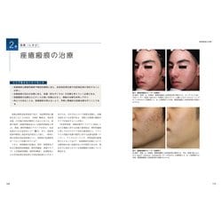 ヨドバシ.com - 脱毛・にきびの治療 美容皮膚科オールラウンド(最新美容皮膚科学大系〈5〉) [全集叢書] 通販【全品無料配達】