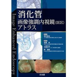 消化管画像強調内視鏡(IEE)アトラス [単行本]