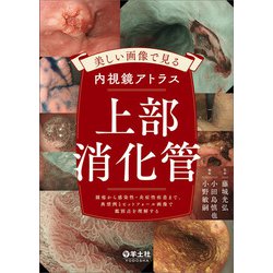 内視鏡診断アトラス 上部・下部消化管 上部消化管内視鏡診断アトラス | 長浜 隆司, 竹内 学 |本 | 通販