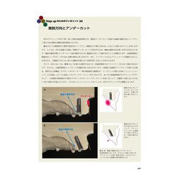 ヨドバシ.com - パーシャルデンチャーの基本を押さえたIOD