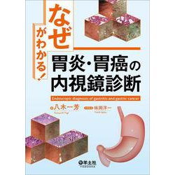 「なぜ」がわかる！胃炎・胃癌の内視鏡診断 [単行本]