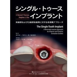 ヨドバシ.com - シングル・トゥースインプラント―前歯部および