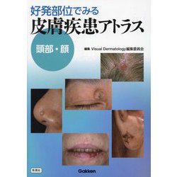 好発部位でみる皮膚疾患アトラス頭部・顔 [単行本]