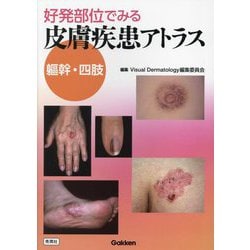 好発部位でみる皮膚疾患アトラス軀幹・四肢 [単行本]