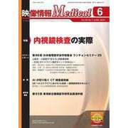 映像情報メディカル 2024年6月号 [ムックその他]