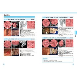 ヨドバシ.com - イチから学ぶ!大腸CT検査―実務・症例・基礎知識