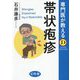 専門医が教える帯状疱疹(SUPER DOCTOR) [単行本]