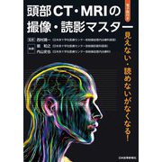 頭部CT・MRIの撮像・読影マスター―見えない・読めないがなくなる! [単行本]
