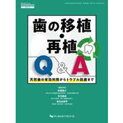 歯の移植・再植Q＆A-天然歯の有効利用からトラブル回避まで [単行本]
