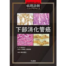 ヨドバシ.com - 下部消化管癌（癌治療戦略に活かす病理診断