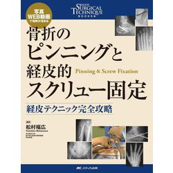 骨折のピンニングと経皮的スクリュー固定―経皮テクニック完全攻略(整形外科SURGICAL TECHNIQUE BOOKS〈13〉) [単行本]