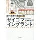 歯科医療の最後の砦「ザイゴマインプラント」―口の中の不安がすべて解消して、人生が変わる! [単行本]