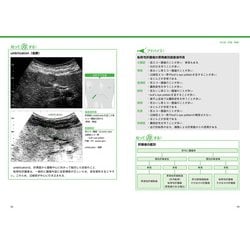 ヨドバシ.com - 超音波検査報告書の書き方 消化器/消化管-「おっ