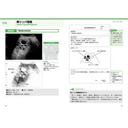 超音波検査報告書の書き方【消化器/消化管】 (「おっ」と思わ