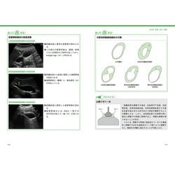 ヨドバシ.com - 超音波検査報告書の書き方 消化器/消化管-「おっ