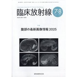 臨床放射線 2025年 07月号 [雑誌]