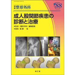 成人股関節疾患の診断と治療(別冊整形外科<88>) [単行本]