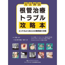 完全解説根管治療トラブル攻略本―エンドのよくある24の難局面大攻略 [単行本]